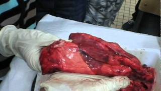 Vidéo Respiration - Apport du dioxygène au sang - Vidéos pédagogiques - SVT : 1ere Secondaire